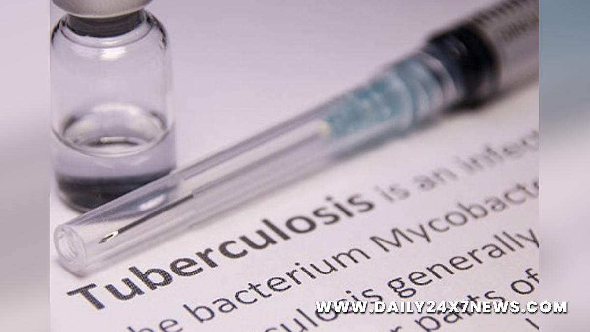 Health, Study, New York, Research, Researchers, World News, Tuberculosis