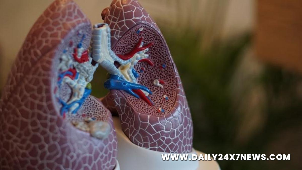 Health, Study, New York, Research, Researchers, World News