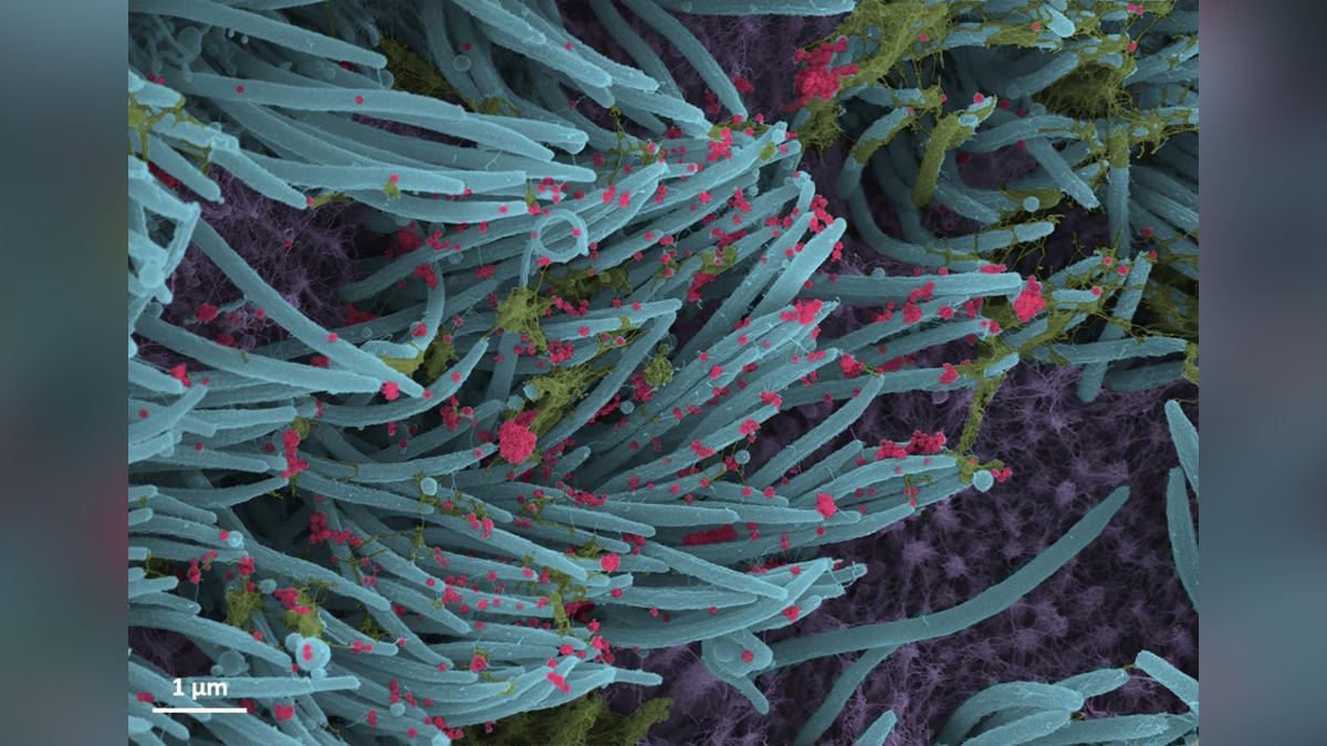 XE variant, Omicron Variant, Delta Plus Covid variant, Delta Covid-19 variant, Coronavirus, Health, Research, Study, Researchers, COVID 19, Novel Coronavirus, Fight Against Corona, Covaxin, Covishield, Oxygen, SARS-CoV-2, Sputnik V, Oxygen Plants, Pfizer, Astra Zeneca, Oxygen Concentrator, Remdesivir, Liquid Medical Oxygen, Oximeter