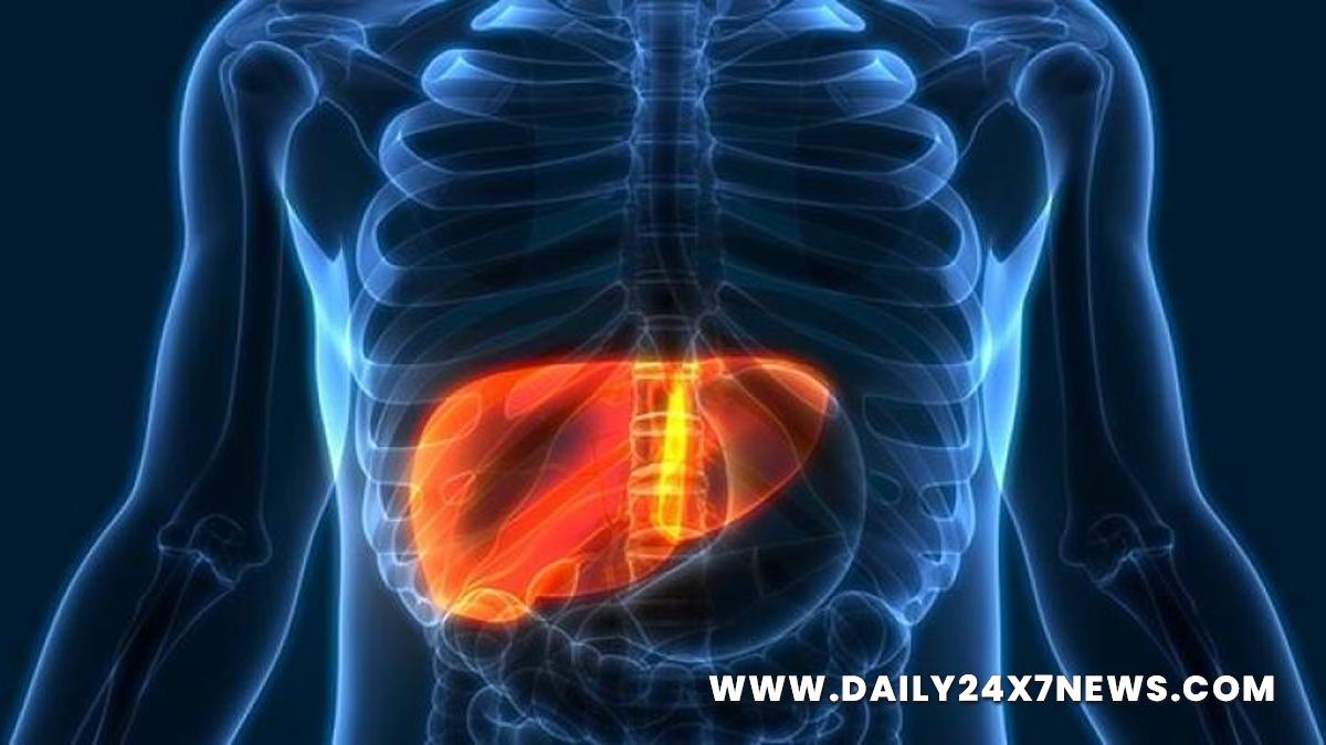 Health, Study, Los Angeles, World News, Hepatitis