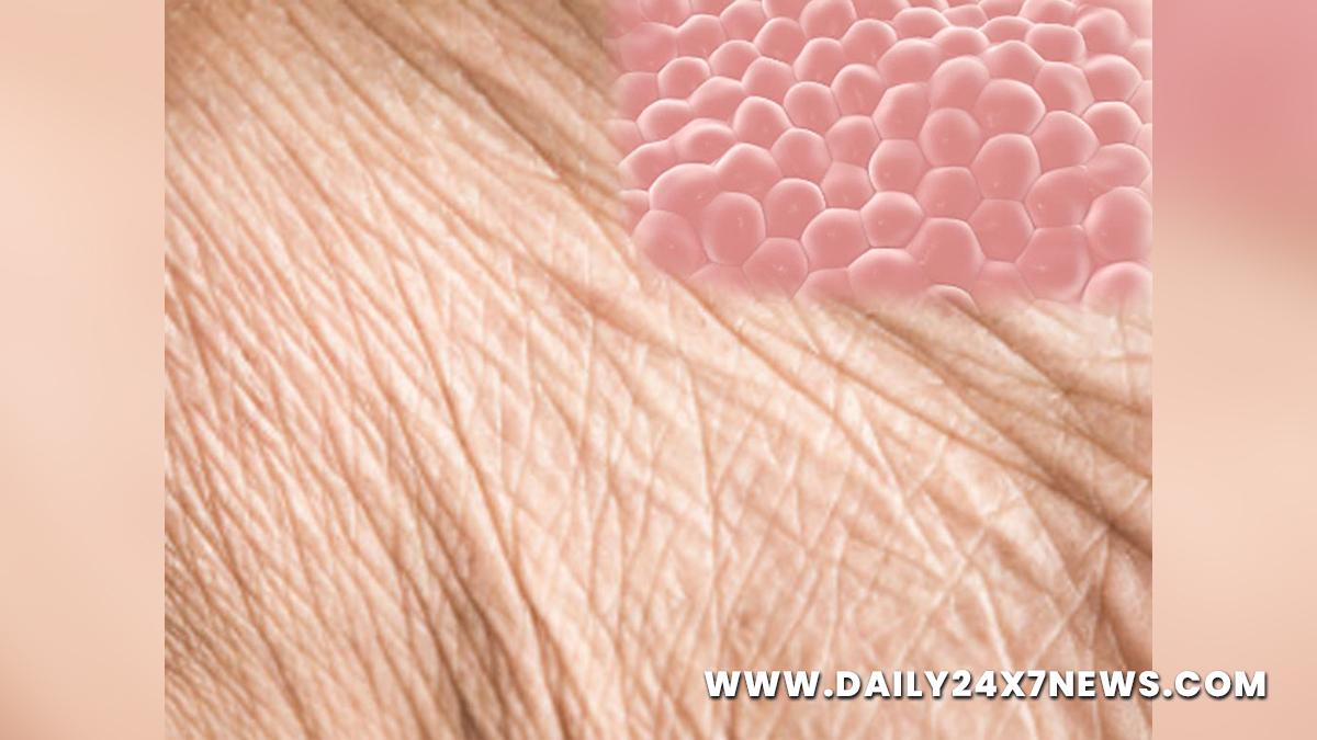 Health, Study, New York, Research, Researchers, World News