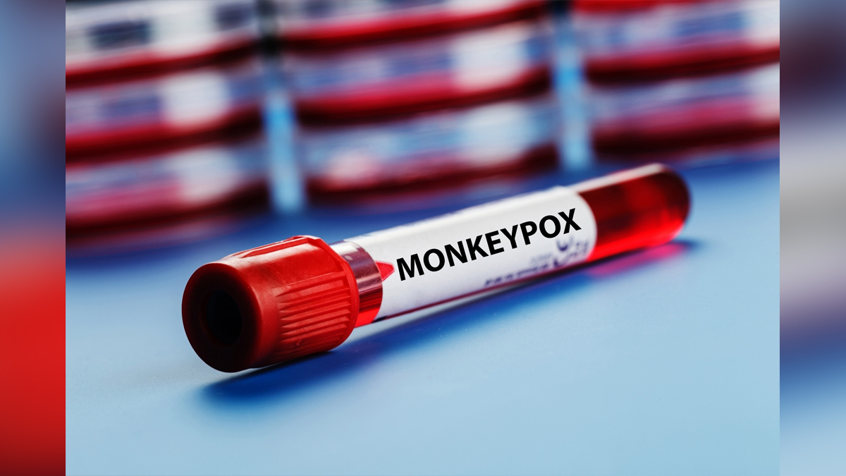 Health, Monkeypox Virus, Monkeypox, Health, Study, Research, Researches, Symptoms Monkeypox Virus, MonkeyPox Disease, Monkeypox Symptoms, MonkeyPox Cures