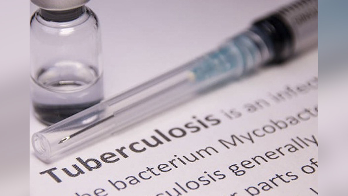 Health, Study, New York, Research, Researchers, World News, Bacille Calmette Guerin, BCG