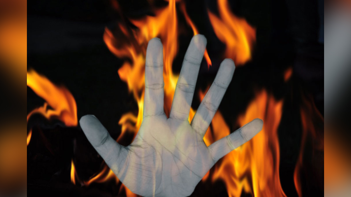 Crime News India, Crime News, Jaipur, Temple Priest On Fire, Girraj Sharma, Temple Priest Girraj Sharma