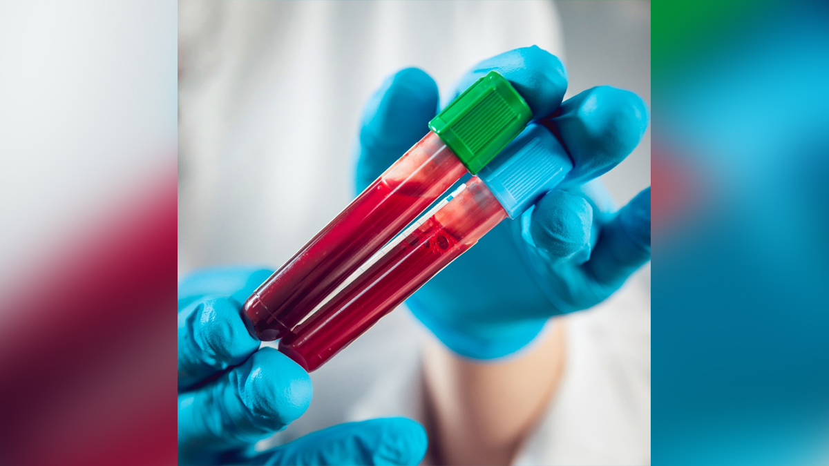 XE variant, Omicron Variant, Delta Plus Covid variant, Delta Covid-19 variant, Coronavirus, Health, Research, Study, Researchers, COVID 19, Novel Coronavirus, Fight Against Corona, Covaxin, Covishield, Oxygen, SARS-CoV-2, Sputnik V, Oxygen Plants, Pfizer, Astra Zeneca, Oxygen Concentrator, Remdesivir, Liquid Medical Oxygen, Oximeter