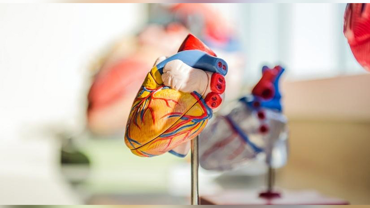 Health, Study, Tehran, Research, Researchers, World News, Premature Coronary Artery Disease, PCAD