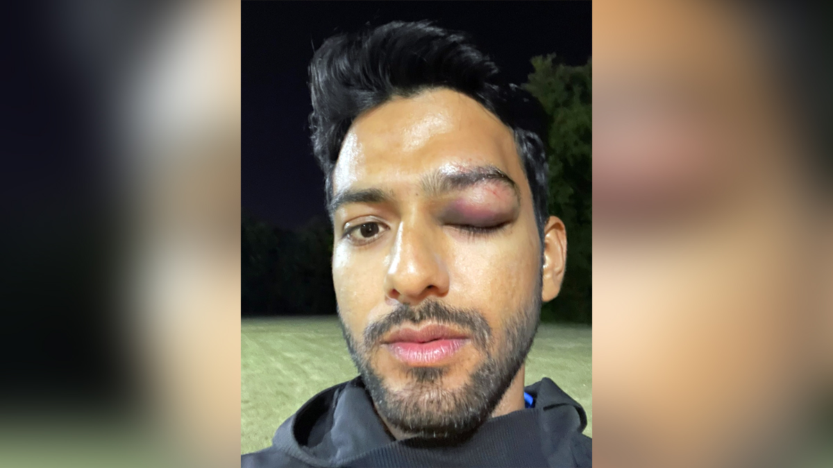 Sports News, Cricket, Cricketer, Player, Bowler, Batsman, Unmukt Chand, Minor League Cricket, MLC
