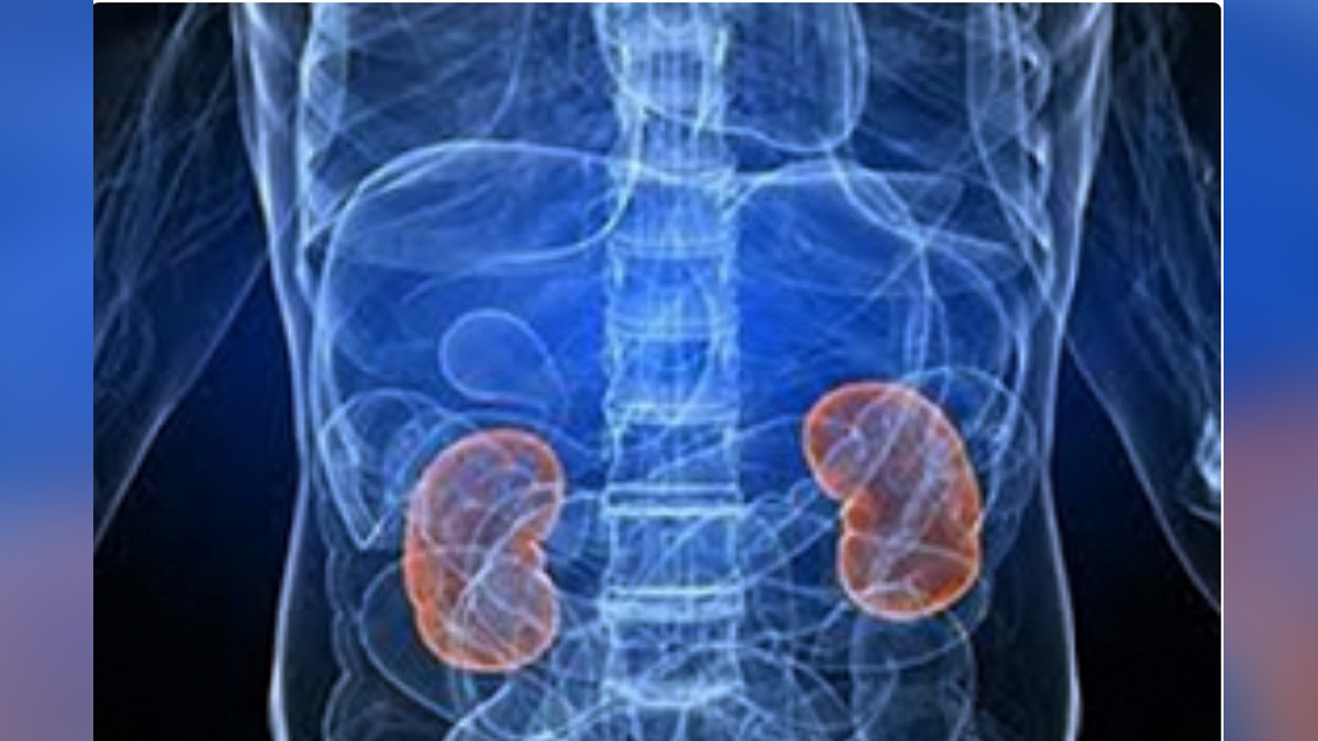 Health, Study, New Delhi, Research, Researchers, Kidney Disease Risk